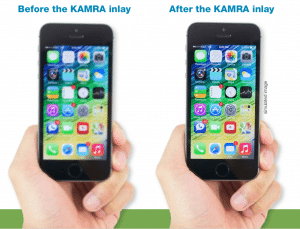 How Does KAMRA Inlay Work